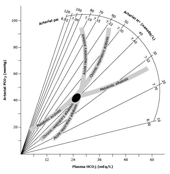 metabolik asidoz kompenzasyon