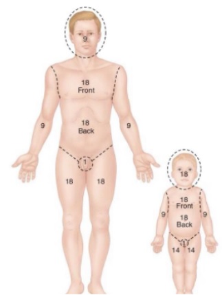 parkland-9-lar-kuralı