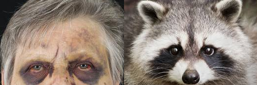 Racoon eye görüntüsü